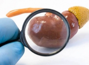 Nguyên nhân nào khiến bạn mắc hội chứng thận hư nhiễm mỡ?